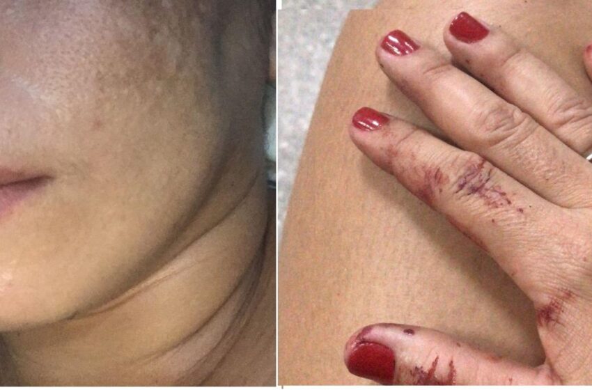  Cantora denuncia namorado por agressão, no Interior do Ceará.